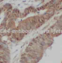 ABCA4 antibody - Click Image to Close