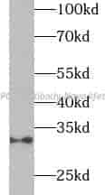 ADIPOQ antibody - Click Image to Close