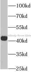 AGER antibody - Click Image to Close