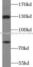 AMOT antibody - Click Image to Close