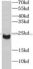 ANGPTL8 Antibody - Click Image to Close