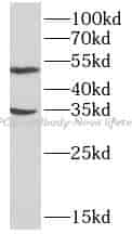 APOE antibody - Click Image to Close