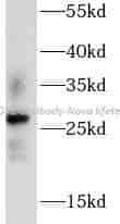AQP2 antibody - Click Image to Close
