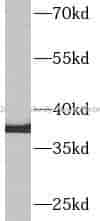 AQP9 antibody - Click Image to Close