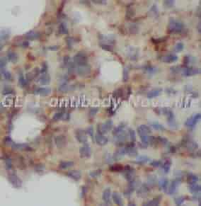ARHGEF1 antibody - Click Image to Close