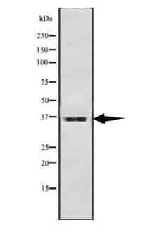 ATOH8 Antibody - Click Image to Close
