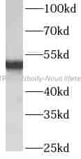 ATPB antibody - Click Image to Close
