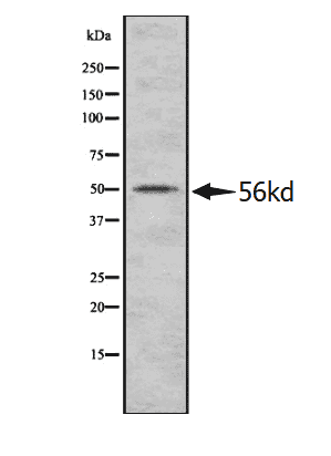 Anti-GSR antibody - Click Image to Close