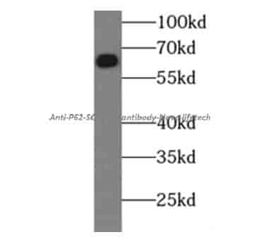 anti- P62/SQSTM1 antibody