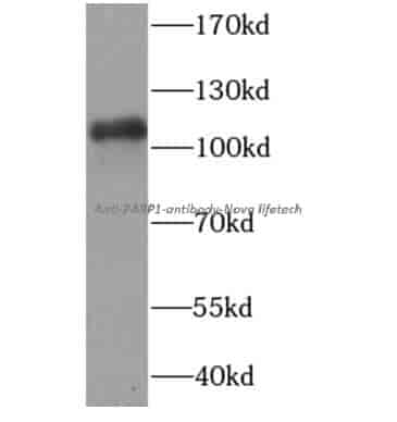 anti- PARP1 antibody - Click Image to Close