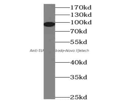 anti- TLR2 antibody - Click Image to Close