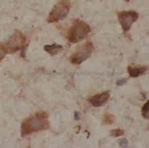 anti- TUBB3 specific antibody - Click Image to Close