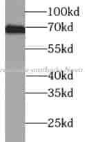 Anti-Tyrosinase antibody - Click Image to Close