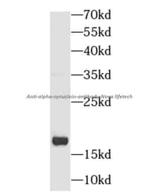 anti- alpha-synuclein antibody - Click Image to Close