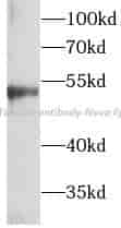 Beta Tubulin antibody - Click Image to Close