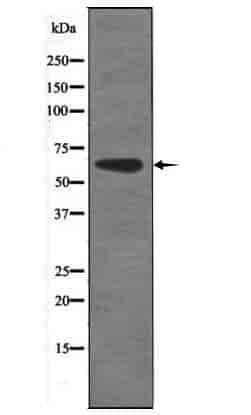 CAMKK1/2 (Phospho- Ser458/495) Antibody - Click Image to Close