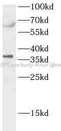CASP7 antibody - Click Image to Close