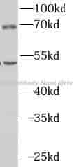 CBPN antibody - Click Image to Close