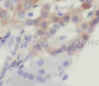 CCK antibody - Click Image to Close