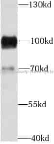 CD19 antibody - Click Image to Close