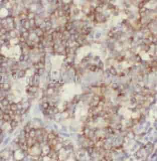 CD21 antibody - Click Image to Close