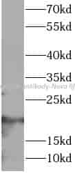 CD3 epsilon antibody - Click Image to Close