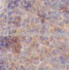 CD44 antibody - Click Image to Close