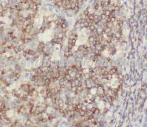 CD6 antibody - Click Image to Close