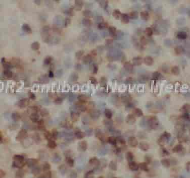 CDR2 antibody - Click Image to Close