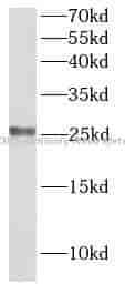 CLDN5 antibody - Click Image to Close