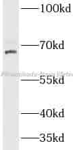 CLPX antibody - Click Image to Close