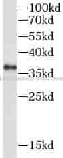 CTLA4 antibody - Click Image to Close