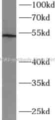 CX3CR1 antibody - Click Image to Close