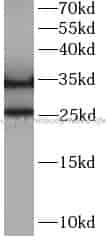 Caspase 8 antibody - Click Image to Close