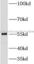Cdc20 antibody - Click Image to Close