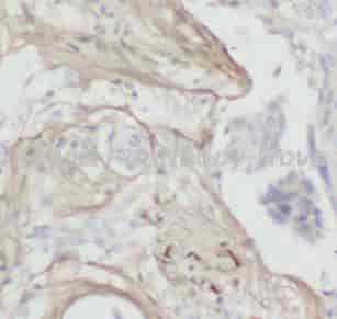 Collagen Type I antibody - Click Image to Close