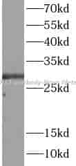 DDIT3 antibody - Click Image to Close
