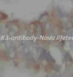 ELK3 antibody - Click Image to Close