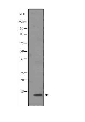 ELOC Antibody - Click Image to Close