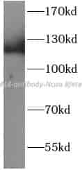 EML4 antibody - Click Image to Close