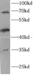 Endoglin/CD105 antibody - Click Image to Close