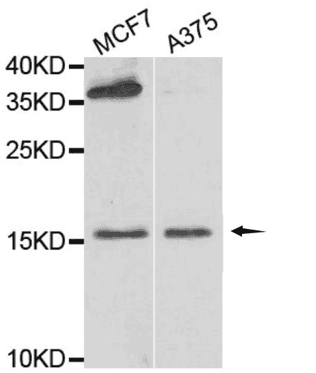 FABP6 Antibody - Click Image to Close