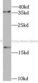 FHIT antibody - Click Image to Close