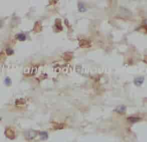 FSHR antibody - Click Image to Close