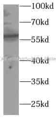 GLPK antibody - Click Image to Close