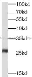 GSTM1 antibody - Click Image to Close