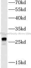 GSTM1 antibody - Click Image to Close