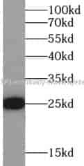 GSTP1 antibody - Click Image to Close