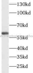 HDAC2 antibody - Click Image to Close