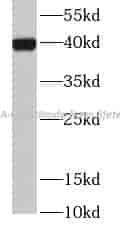HLA-G antibody - Click Image to Close